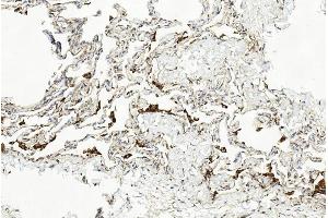 Immunohistochemical analysis of paraffin-embedded Human lung section using Pink1 am1851b.