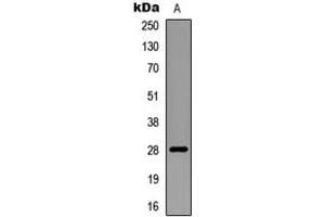 Western blot analysis of RNF138 expression in mouse multiple (A) whole cell lysates. (RNF138 抗体  (Center))