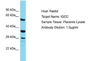 Host: Rabbit Target Name: IQCC Sample Tissue: Human Placenta Antibody Dilution: 1ug/ml (IQCC 抗体  (Middle Region))