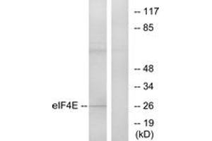 Western blot analysis of extracts from NIH-3T3 cells, treated with FBS, using eIF4E (Ab-209) Antibody. (EIF4E 抗体  (AA 168-217))
