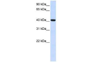 DGAT2L4 antibody used at 1 ug/ml to detect target protein. (AWAT2 抗体  (C-Term))