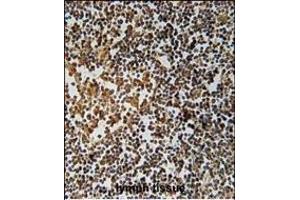 PYHIN1 Antibody (N-term) (ABIN651569 and ABIN2840306) immunohistochemistry analysis in formalin fixed and paraffin embedded human lymph tissue followed by peroxidase conjugation of the secondary antibody and DAB staining. (PYHIN1 抗体  (N-Term))