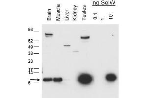 Image no. 1 for anti-Selenoprotein W, 1 (SEPW1) antibody (ABIN401399) (Selenoprotein W 抗体)