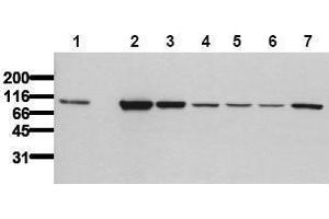 Western Blotting (WB) image for anti-Catenin (Cadherin-Associated Protein), beta 1, 88kDa (CTNNB1) (Exon 2), (N-Term) antibody (ABIN126745) (CTNNB1 抗体  (Exon 2, N-Term))