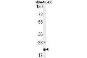 Western Blotting (WB) image for anti-Membrane-Spanning 4-Domains, Subfamily A, Member 4 (MS4A4A) antibody (ABIN2995855) (MS4A4A 抗体)