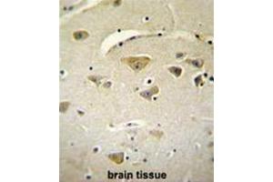 anti-V-Set and Transmembrane Domain Containing 2A (VSTM2A) (AA 103-133), (Middle Region) antibody