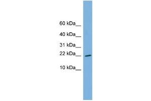 WB Suggested Anti-RPS13 Antibody Titration: 0. (RPS13 抗体  (Middle Region))