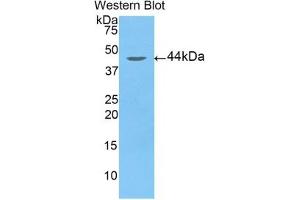 Detection of Recombinant ARRb2, Human using Polyclonal Antibody to Arrestin Beta 2 (ARRb2) (Arrestin 3 抗体  (AA 262-430))