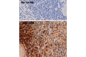 Immunohistochemistry (IHC) image for anti-CD4 (CD4) antibody (ABIN6254232)