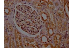 Immunohistochemistry (IHC) image for anti-Prostaglandin E Receptor 2 (Subtype EP2), 53kDa (PTGER2) antibody (ABIN7127782)