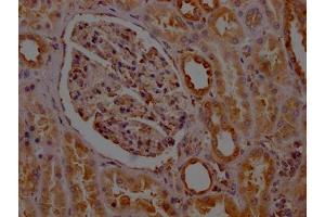 IHC image of ABIN7127782 diluted at 1:100 and staining in paraffin-embedded human kidney tissue performed on a Leica BondTM system. (Recombinant PTGER2 抗体)
