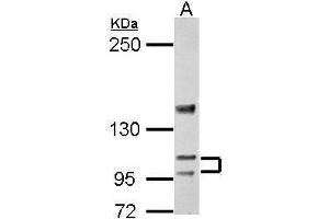 WB Image Sample (30 ug of whole cell lysate) A: BCL-1 5% SDS PAGE antibody diluted at 1:5000 (ATP2A3 抗体  (N-Term))