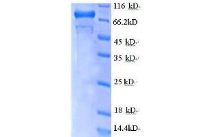 SDS-PAGE (SDS) image for GDP Dissociation Inhibitor 2 (GDI2) (AA 1-441), (partial) protein (GST tag) (ABIN7479184)