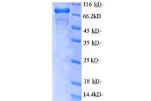 GDP Dissociation Inhibitor 2 (GDI2) (AA 1-441), (partial) protein (GST tag)