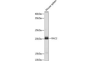 Western Blotting (WB) image for anti-Ras-Related C3 Botulinum Toxin Substrate 2 (Rho Family, Small GTP Binding Protein Rac2) (RAC2) (AA 1-192) antibody (ABIN3021524)