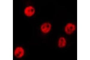 ABIN6275790 staining HepG2 by IF/ICC. (CSRNP3 抗体  (Internal Region))