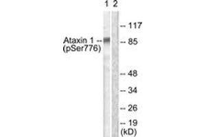 Western blot analysis of extracts from HepG2 cells treated with Adriamycin 0. (Ataxin 1 抗体  (pSer776))