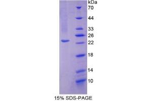 SDS-PAGE analysis of Mouse SOD2 Protein. (SOD2 蛋白)