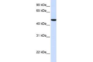 Western Blotting (WB) image for anti-Solute Carrier Family 2 (Facilitated Glucose Transporter), Member 6 (SLC2A6) (N-Term) antibody (ABIN2781652)