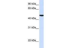 WB Suggested Anti-SLC2A6 Antibody Titration:  0. (SLC2A6 抗体  (N-Term))