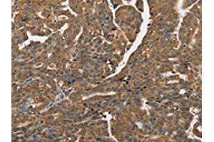 Immunohistochemistry (IHC) image for anti-Protein tyrosine Phosphatase, Non-Receptor Type 2 (PTPN2) antibody (ABIN7192064)