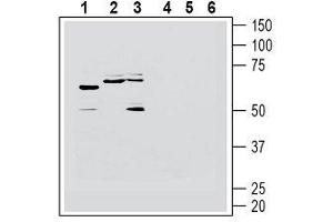 Western blot analysis of human Jurkat T-cell leukemia cell line lysate (lanes 1 and 4), human U-87 MG glioblastoma cell line lysate (lanes 2 and 5) and human SH-SY5Y neuroblastoma cell line lysate (lanes 3 and 6): - 1-3. (HRH1 抗体  (2nd Extracellular Loop))