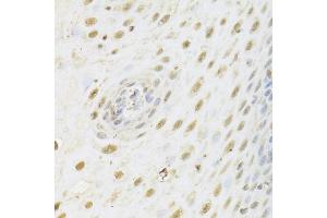 Immunohistochemistry of paraffin-embedded human esophagus using HDAC3 Antibody (ABIN5971166) at dilution of 1/100 (40x lens). (HDAC3 抗体)