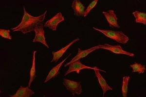 IF analysis of BAT3/BAG6 using anti-BAT3/BAG6 antibody (ABIN6719601) and anti-Beta Tubulin antibody (ABIN7602743). (BAT3 抗体)
