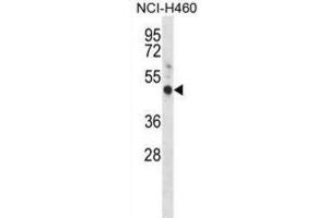 Western Blotting (WB) image for anti-G Protein-Coupled Estrogen Receptor 1 (GPER) antibody (ABIN2998385) (GPER 抗体)