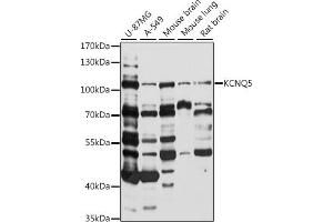 Western Blotting (WB) image for anti-Potassium Voltage-Gated Channel, KQT-Like Subfamily, Member 5 (KCNQ5) (AA 624-923) antibody (ABIN7269479)