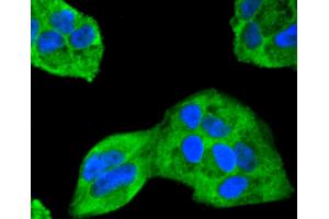 HeLa cells were fixed in paraformaldehyde, permeabilized with 0.