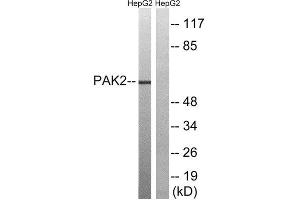 Western Blotting (WB) image for anti-P21-Activated Kinase 2 (PAK2) (Ser192) antibody (ABIN1848249) (PAK2 抗体  (Ser192))