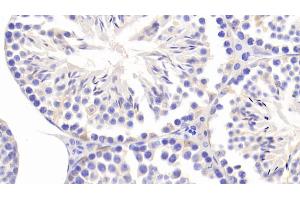 Detection of CCDC60 in Mouse Testis Tissue using Polyclonal Antibody to Coiled Coil Domain Containing Protein 60 (CCDC60) (CCDC60 抗体  (AA 1-186))