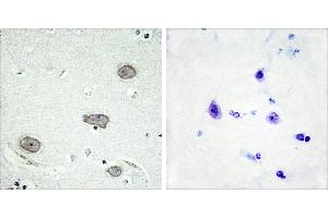 P-peptide - +Immunohistochemistry analysis of paraffin-embedded human brain tissue using CSFR (Phospho-Tyr809) antibody. (CSF1R 抗体  (pTyr809))