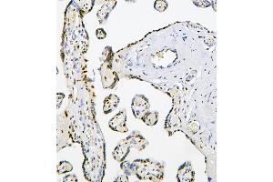 IHC analysis of PHF21A using anti-PHF21A antibody (ABIN6719353). (PHF21A 抗体  (AA 1-97))