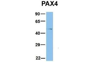 Host:  Rabbit  Target Name:  PAX4  Sample Type:  COLO205  Antibody Dilution:  1. (PAX4 抗体  (Middle Region))