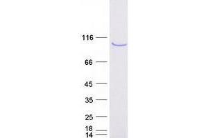 Western Blotting (WB) image for OTU Domain Containing 7B (OTUD7B) protein (Myc-DYKDDDDK Tag) (ABIN2735737)