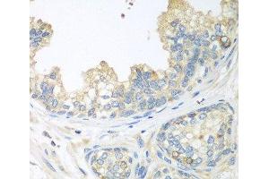 Immunohistochemistry of paraffin-embedded Human prostate using CUL3 Polyclonal Antibody at dilution of 1:100 (40x lens). (Cullin 3 抗体)