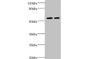 Western blot All lanes: ALDH4A1 antibody at 13 μg/mL Lane 1: K562 whole cell lysate Lane 2: 293T whole cell lysate Secondary Goat polyclonal to rabbit IgG at 1/10000 dilution Predicted band size: 62, 56, 57 kDa Observed band size: 62 kDa (ALDH4A1 抗体  (AA 354-563))