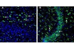 Expression of OCT3 (SLC22A3) in mouse cortex and hippocampus - Immunohistochemical staining of perfusion-fixed frozen mouse brain sections with Anti-SLC22A3 (extracellular) Antibody (ABIN7043416, ABIN7044223 and ABIN7044224), (1:200), followed by goat anti-rabbit-AlexaFluor-488. (SLC22A3 抗体  (Extracellular))