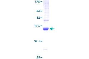 Transforming Growth Factor, alpha (TGFA) (AA 1-159) protein (GST tag)