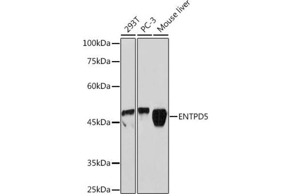 ENTPD5 抗体
