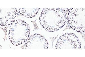 Immunohistochemistry of paraffin-embedded Mouse testis using Bcl9 Polyclonal Antibody at dilution of 1:100 (20x lens). (BCL9 抗体)