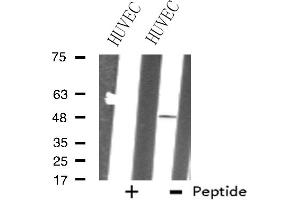 Western blot analysis of extracts from HUVEC cells, using ZNF24 antibody. (ZNF24 抗体  (Internal Region))