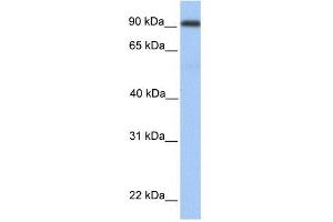 MMEL1 antibody used at 1 ug/ml to detect target protein. (MMEL1 抗体  (Middle Region))