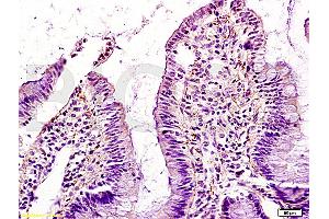 Formalin-fixed and paraffin embedded rat intestine tissue labeled with Anti-GM-CSF Polyclonal Antibody (ABIN730723), Unconjugated at 1:200, followed by conjugation to the secondary antibody and DAB staining (GM-CSF 抗体  (AA 71-141))