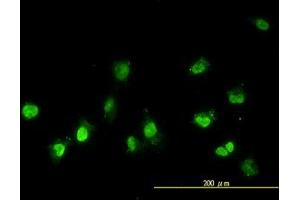 Image no. 2 for anti-NIMA (Never In Mitosis Gene A)-Related Kinase 11 (NEK11) (AA 1-483) antibody (ABIN599307) (NEK11 抗体  (AA 1-483))