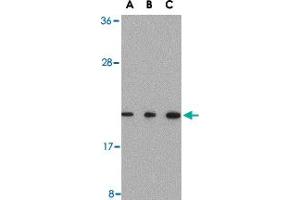 Western blot analysis of TMED10 in Raji cell lysate with TMED10 polyclonal antibody  at (A) 0. (TMED10 抗体  (C-Term))