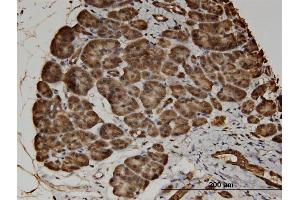Immunoperoxidase of monoclonal antibody to CACNA2D2 on formalin-fixed paraffin-embedded human pancreas.