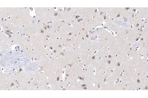 Detection of LCAT in Human Cerebrum Tissue using Monoclonal Antibody to Lecithin Cholesterol Acyltransferase (LCAT) (LCAT 抗体  (AA 290-433))